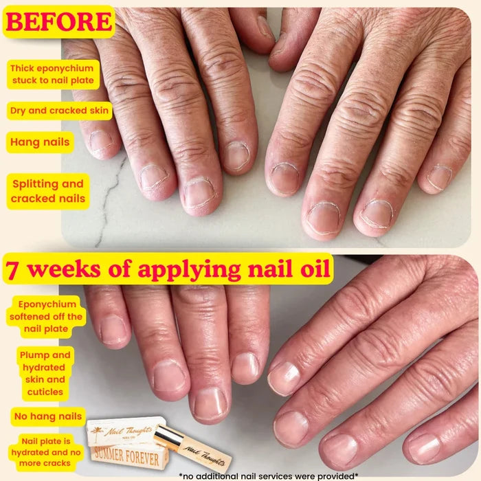 Nail thoughts Nail Oil Summer Forever, 10 ml Cuticle Oil Nail Thoughts