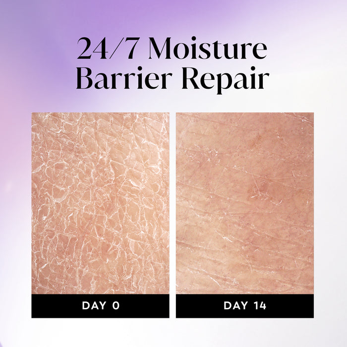 Before and after images using Olay Ultra Moisture Body Wash from day 0 to day 14. 24/7 moisture repair barrier repair