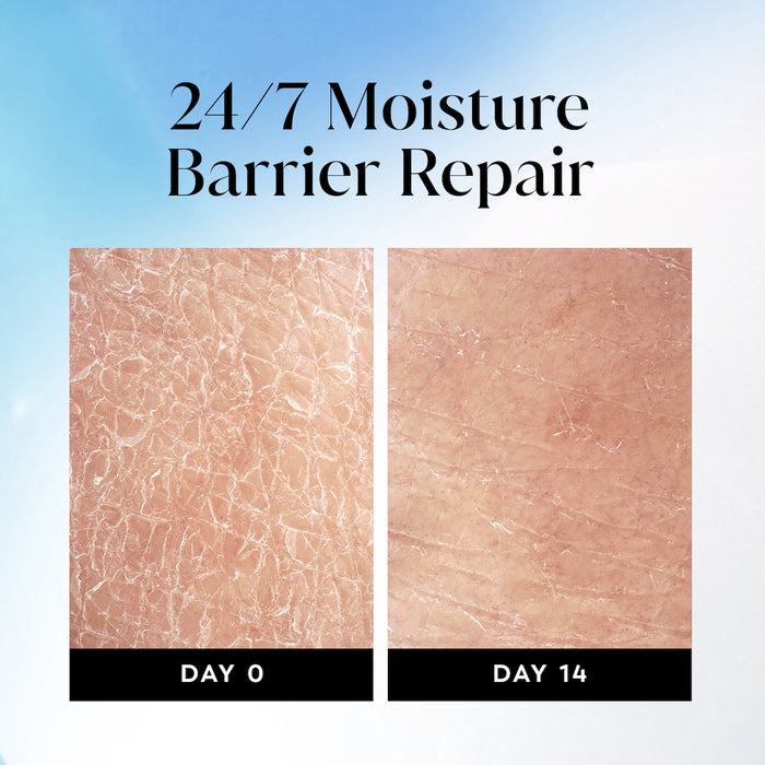 Before and after images using Olay Ultra Moisture Body Wash from day 0 to day 14. 24/7 moisture repair barrier repair