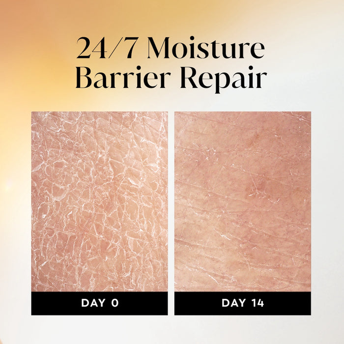 Before and after images using Olay Ultra Moisture Body Wash from day 0 to day 14. 24/7 moisture repair barrier repair