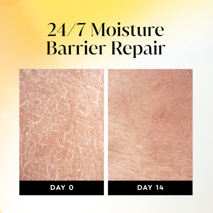 Before and after images using Olay Ultra Moisture Body Wash with Shea Butter, Vitamin B3 and Hyaluronic Blend from day 0 to day 14. 24/7 moisture repair barrier repair