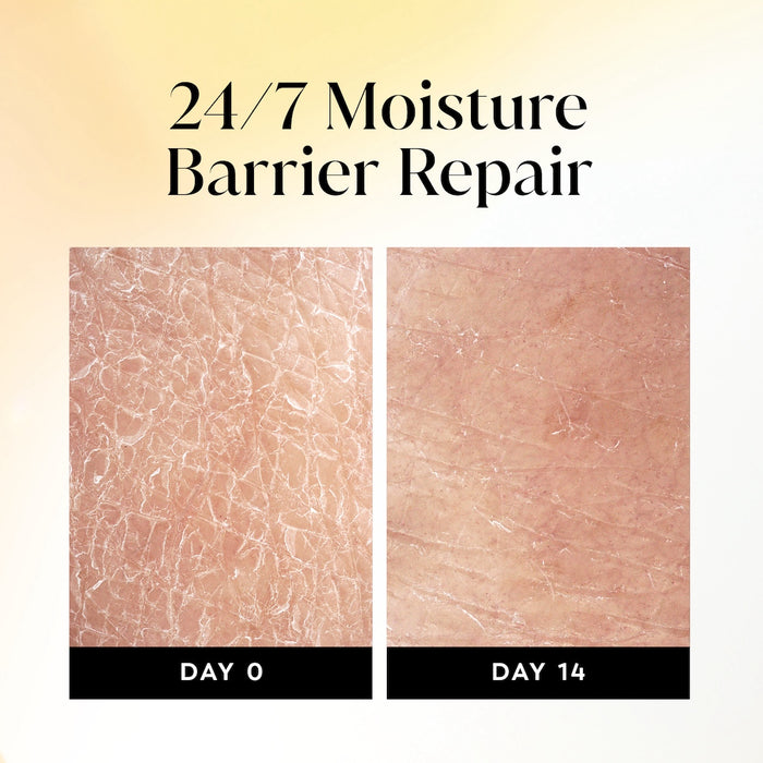 Before and after images using Olay Ultra Moisture Body Wash. Day 0 and day 14. 24/7 moisture barrier repair