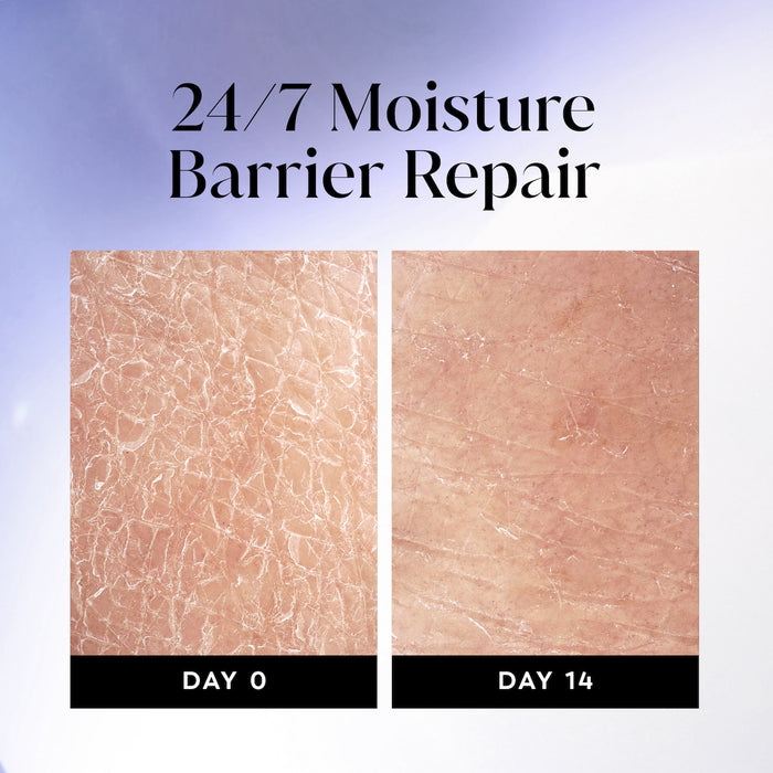 Before and after images using Olay Ultra Moisture Body Wash from day 0 to day 14. 24/7 moisture repair barrier repair